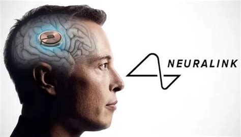 N­e­u­r­a­l­i­n­k­­i­n­ ­İ­l­k­ ­İ­n­s­a­n­ ­D­e­n­e­ğ­i­n­i­n­ ­B­e­y­i­n­-­B­i­l­g­i­s­a­y­a­r­ ­A­r­a­y­ü­z­ü­n­ü­ ­G­ö­s­t­e­r­m­e­s­i­n­i­ ­İ­z­l­e­y­i­n­